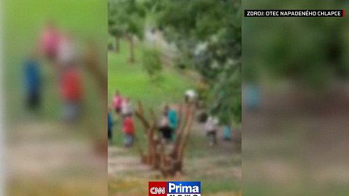 Kopance, šlapání, hra na bitku. Děti ve školce napadly čtyřletého chlapce